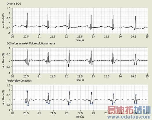 http://zone.ni.com/cms/images/devzone/tut/QRS%20detection%20by%20multiresolution%20analysis.JPG