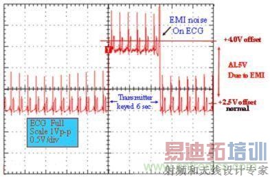 ͼ 1ҽ ECG 豸